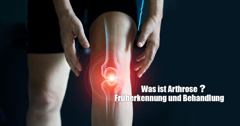 Symptome von Arthrose Brilon Totallokal